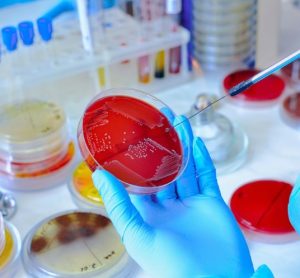 Why is microbiological testing in medical device manufacturing important?