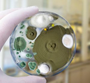 Colonies of different mold fungi grown from indoor air on Petri dish