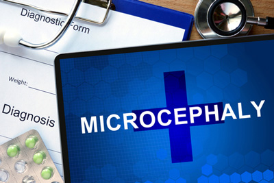 microcephaly