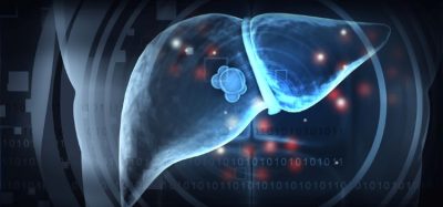 Clinical trial-first for early hepatocellular carcinoma immunotherapy combination - Tecentriq® plus Avastin®