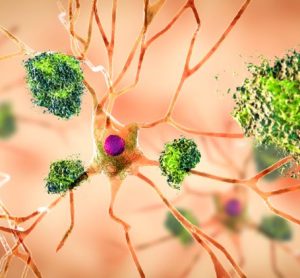 Learning from lecanemab: a breakthrough treatment for Alzheimer’s