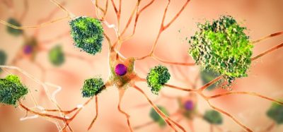 Learning from lecanemab: a breakthrough treatment for Alzheimer’s