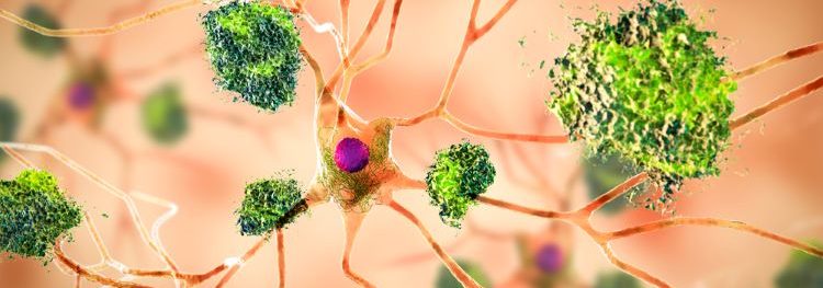 Learning from lecanemab: a breakthrough treatment for Alzheimer’s
