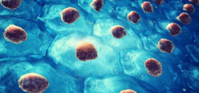 Combination therapy facilitates optimal stem cell collection - motixafortide and standard stem cell therapy