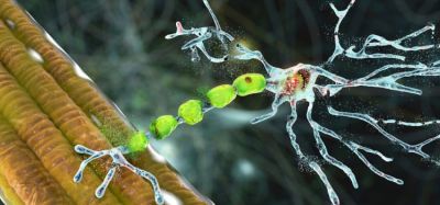Three dimensional concept of motor neuron degradation