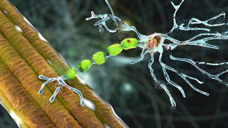 Three dimensional concept of motor neuron degradation