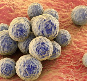 Treatment for MRSA no longer more costly than for susceptible Staph aureus infections