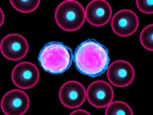 multiple myeloma