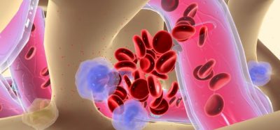 Multiple myeloma bispecific antibody granted accelerated approval