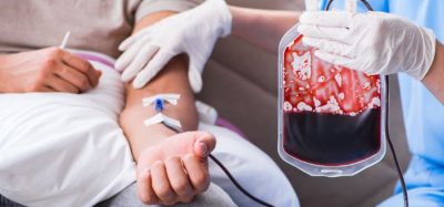 New therapy for anaemic myelodysplastic cancer patients