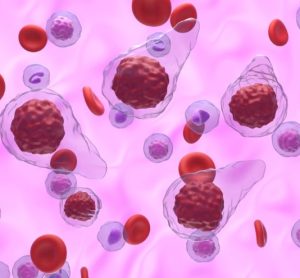 First treatment for myelofibrosis with anaemia approved by FDA