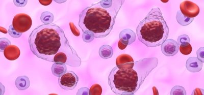 First treatment for myelofibrosis with anaemia approved by FDA