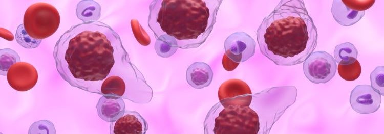 First treatment for myelofibrosis with anaemia approved by FDA