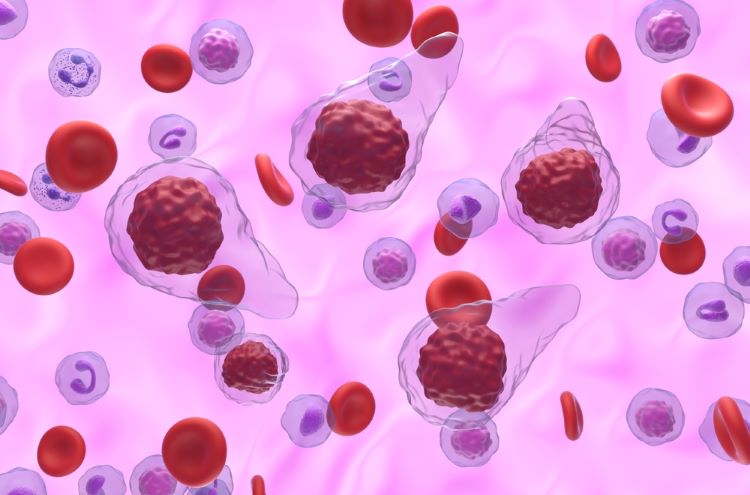 First treatment for myelofibrosis with anaemia approved by FDA