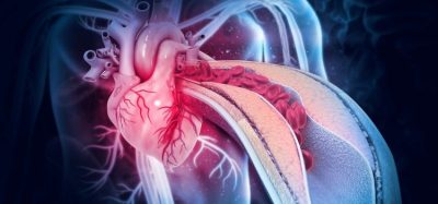 First clinical trial will test new heart attack drug