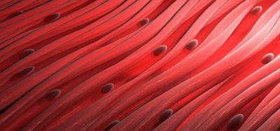 First targeted delivery of siRNA into muscle - to treat myotonic dystrophy type 1