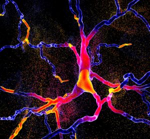 Neurodegeneration - nerves disintegrating, idea of neurodegenerative disease