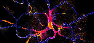 Neurodegeneration - nerves disintegrating, idea of neurodegenerative disease