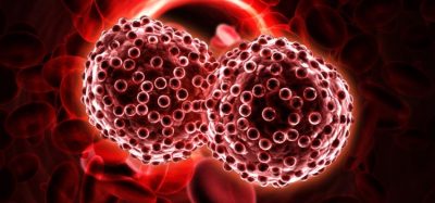 Neoadjuvant nivolumab improves long-term survival for lung cancer