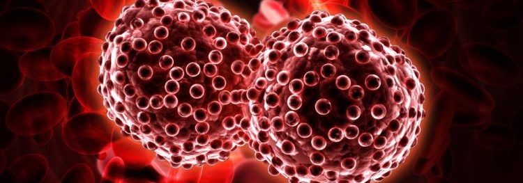 Neoadjuvant nivolumab improves long-term survival for lung cancer