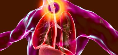 Anti-PD-1 antibody tislelizumab gains EU approval for oesophageal cancer