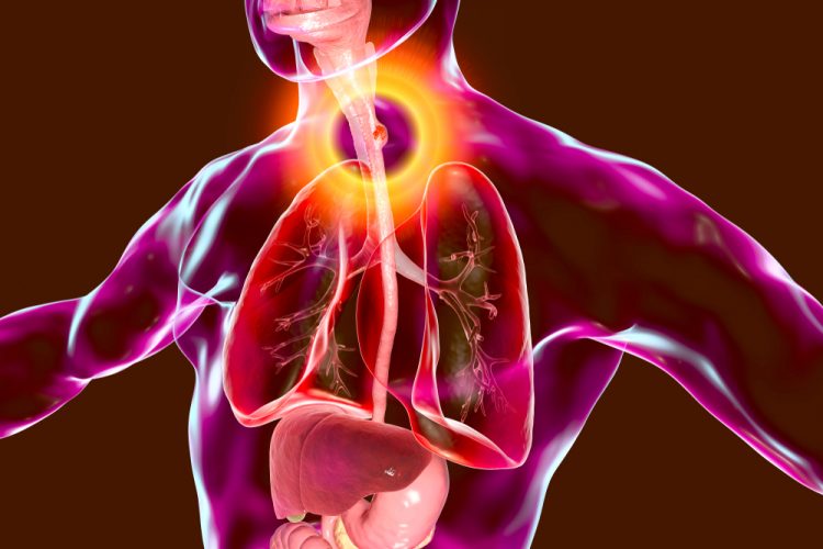 3D illustration showing malignant tumor in the human oesophagus