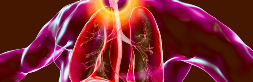 3D illustration showing malignant tumor in the human oesophagus