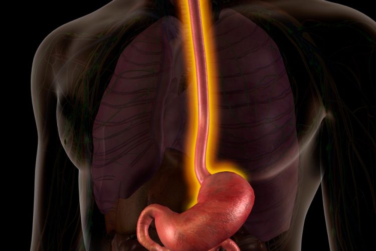 Male Internal Anatomy with Inflamed oesophagus indicating oesophagitis