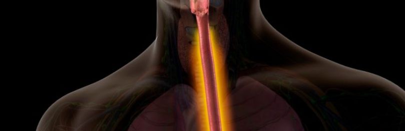 Male Internal Anatomy with Inflamed oesophagus indicating oesophagitis