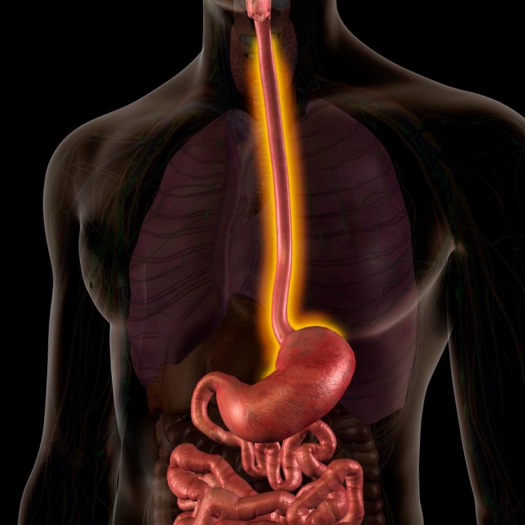 Male Internal Anatomy with Inflamed oesophagus indicating oesophagitis