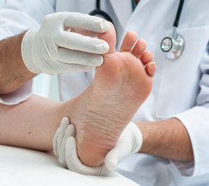 onychomycosis nail