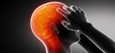 NICE recommends oral migraine treatment for first time