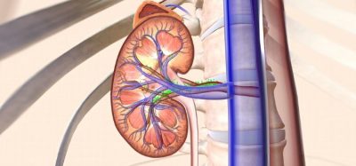 First-in-class oral small molecule trial data presented at 2023 ERA Congress