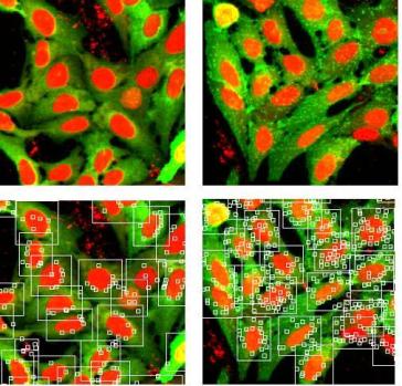 Figure 2 Transfluor® GPCR in cell imaging. Detail of images in the absence (left) and presence (right) of agonist. These images represent approximately 1/100 of the full image field. In the lower panels, bitmaps illustrate the granularity analysis