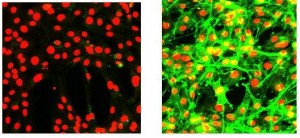 Figure 5 IN Cell Analyzer™ images of mouse fibroblasts expressing human RTK. DRAQ5™ nucleus stain in red channel, Alexa Fluor® 488 tagged anti-phospho RTK. These images represent 25 per cent of the full image field