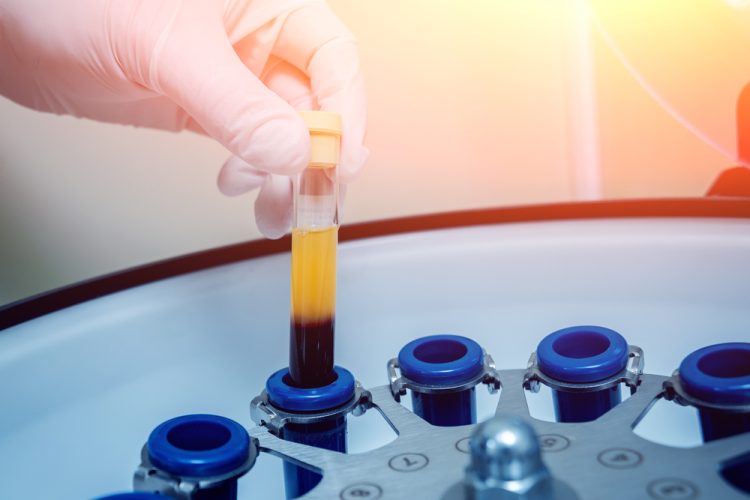 concept of blood plasma-derived therapy production - hand removing a test tube of blood from a centrifuge with large section of yellow blood plasma separated at the top