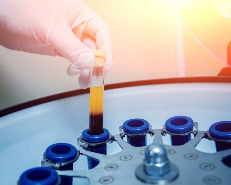 concept of blood plasma-derived therapy production - hand removing a test tube of blood from a centrifuge with large section of yellow blood plasma separated at the top