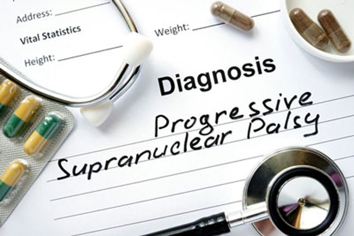 progressive supranuclear palsy