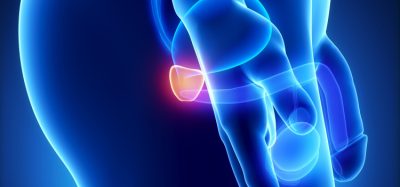 FDA approval for Janssen’s prostate cancer treatment