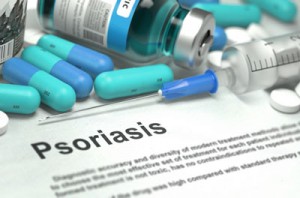 psoriasis-Brodalumab