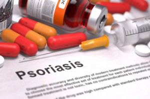 psoriasis-enstilar