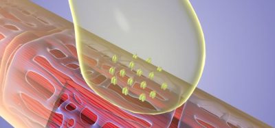 First RNA CAR-T therapy autoimmunity trial shows potential