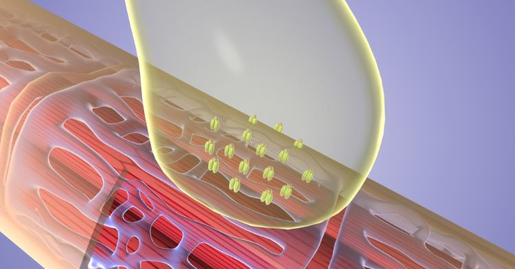 First RNA CAR-T therapy autoimmunity trial shows potential