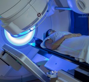 Radiotherapy treatment