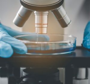 Rapid microbiology testing market growth expected 2022 to 2027