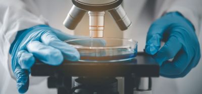 Rapid microbiology testing market growth expected 2022 to 2027