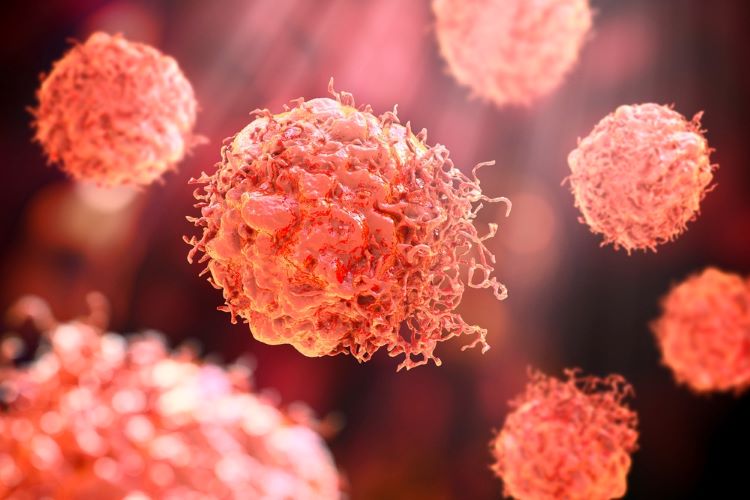 Lymphoma maintenance therapy resminostat delivers promise in CTCL