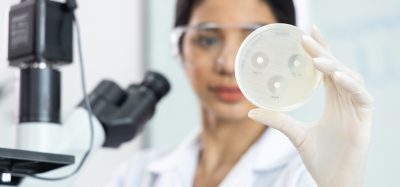 Scientist in lab looking at bacteria in petri dish