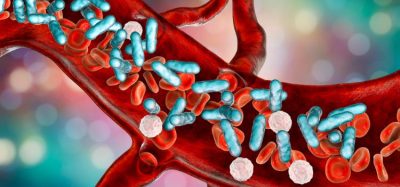 CER-001 potential treatment identified for septic patients