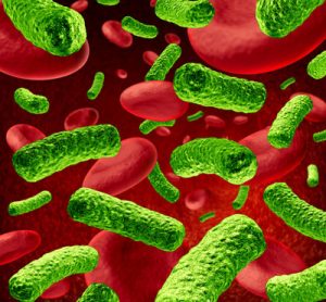 sepsis